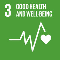 SDG Wheel